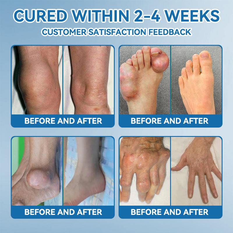 🩵Flysmus™ BPC-157 Joint Healing Cream🦴Treats Arthritis, Neuropathy, Rheumatism, Sports Injuries & More👍