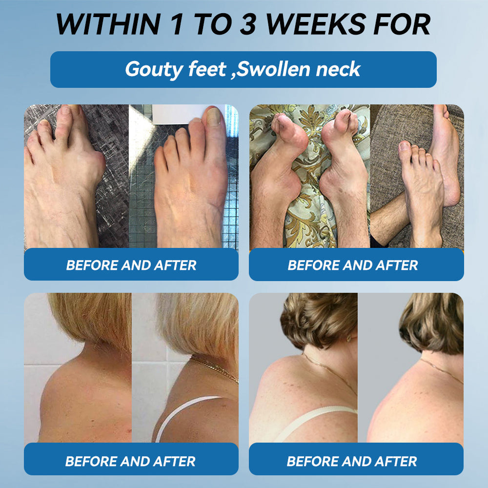 🩵Flysmus™ BPC-157 Joint Healing Cream🦴Treats Arthritis, Neuropathy, Rheumatism, Sports Injuries & More👍