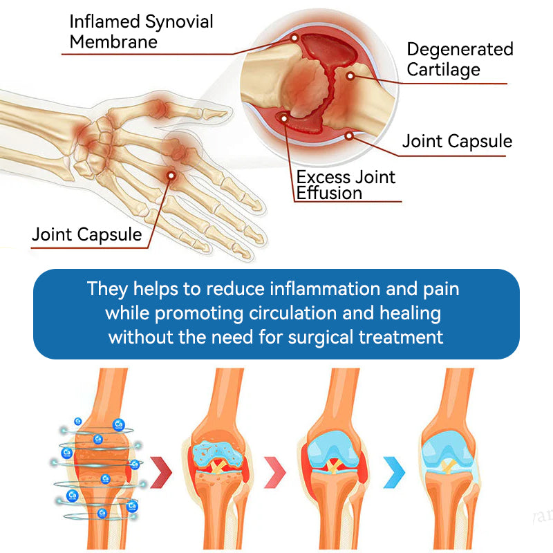 ⛷️Flysmus™ BPC-157 Joint Healing Cream🦴Treats Arthritis, Neuropathy, Rheumatism, Sports Injuries & More👍