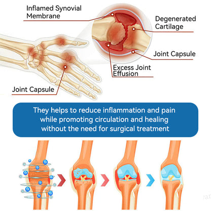 ⛷️Flysmus™ BPC-157 Joint Healing Cream🦴Treats Arthritis, Neuropathy, Rheumatism, Sports Injuries & More👍
