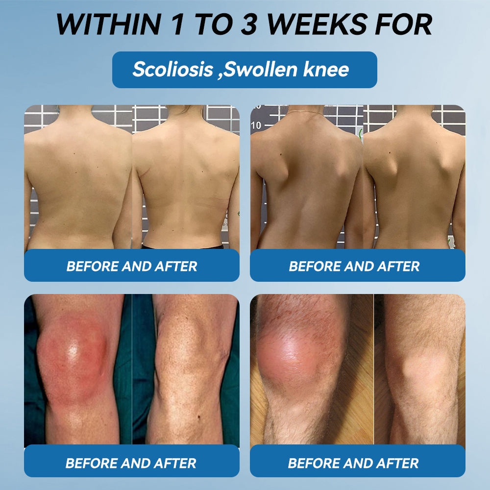⛷️Flysmus™ BPC-157 Joint Healing Cream🦴Treats Arthritis, Neuropathy, Rheumatism, Sports Injuries & More👍