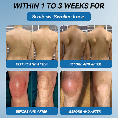 ⛷️Flysmus™ BPC-157 Joint Healing Cream🦴Treats Arthritis, Neuropathy, Rheumatism, Sports Injuries & More👍