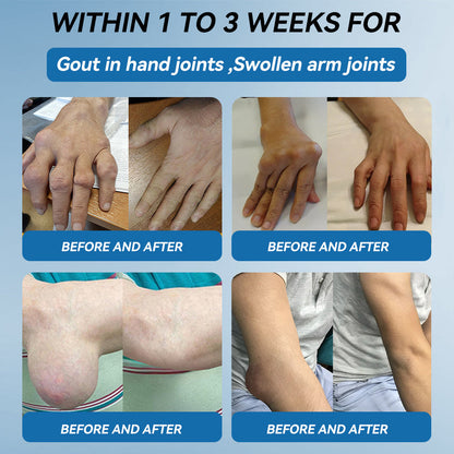 ⛷️Flysmus™ BPC-157 Joint Healing Cream🦴Treats Arthritis, Neuropathy, Rheumatism, Sports Injuries & More👍